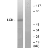 Western Blot - Anti-Lck Antibody (B7139) - Antibodies.com