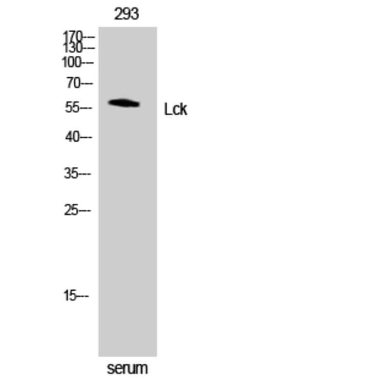 Western Blot - Anti-Lck Antibody (B7139) - Antibodies.com