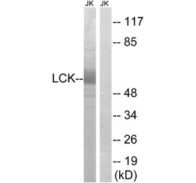Western Blot - Anti-Lck Antibody (B8215) - Antibodies.com