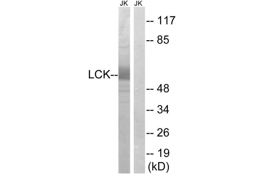 Western Blot - Anti-Lck Antibody (B8215) - Antibodies.com