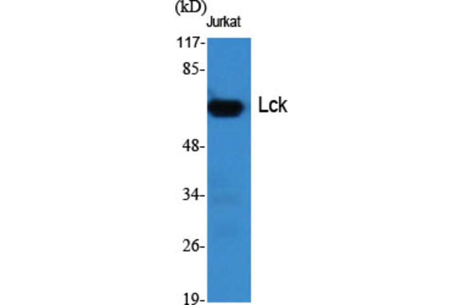 Western Blot - Anti-Lck Antibody (B8215) - Antibodies.com