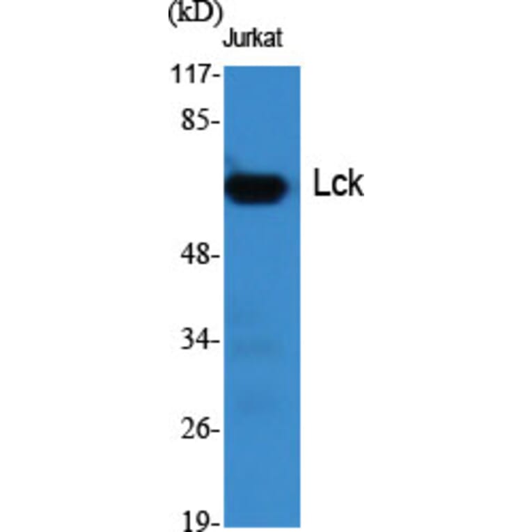 Western Blot - Anti-Lck Antibody (B8215) - Antibodies.com