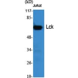 Western Blot - Anti-Lck Antibody (B8215) - Antibodies.com