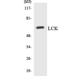 Western Blot - Anti-LCK Antibody (R12-2963) - Antibodies.com