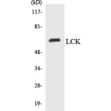 Western Blot - Anti-LCK Antibody (R12-2963) - Antibodies.com