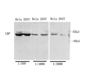 Western Blot - Anti-LBP Antibody (C21666) - Antibodies.com