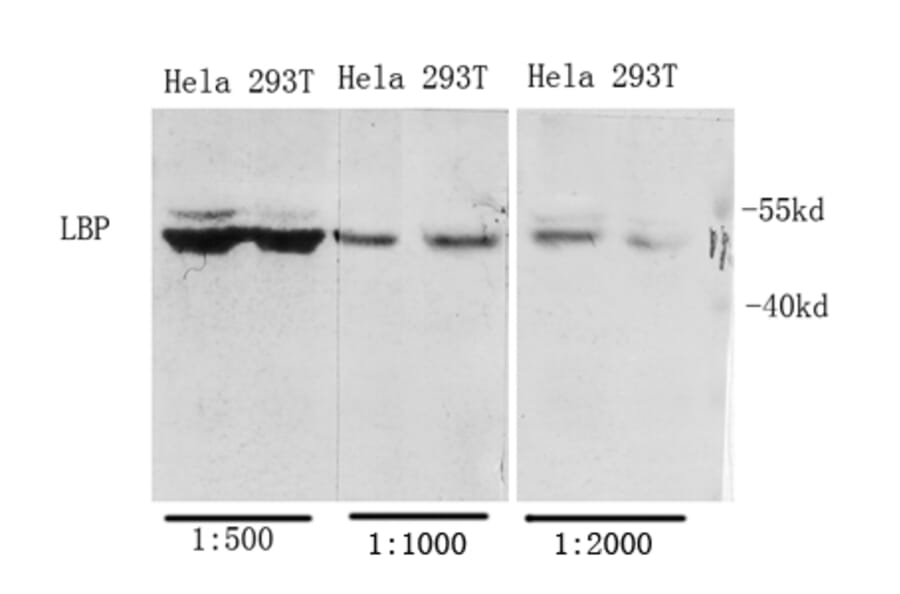 Western Blot - Anti-LBP Antibody (C21666) - Antibodies.com
