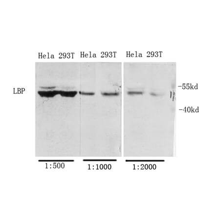 Western Blot - Anti-LBP Antibody (C21666) - Antibodies.com