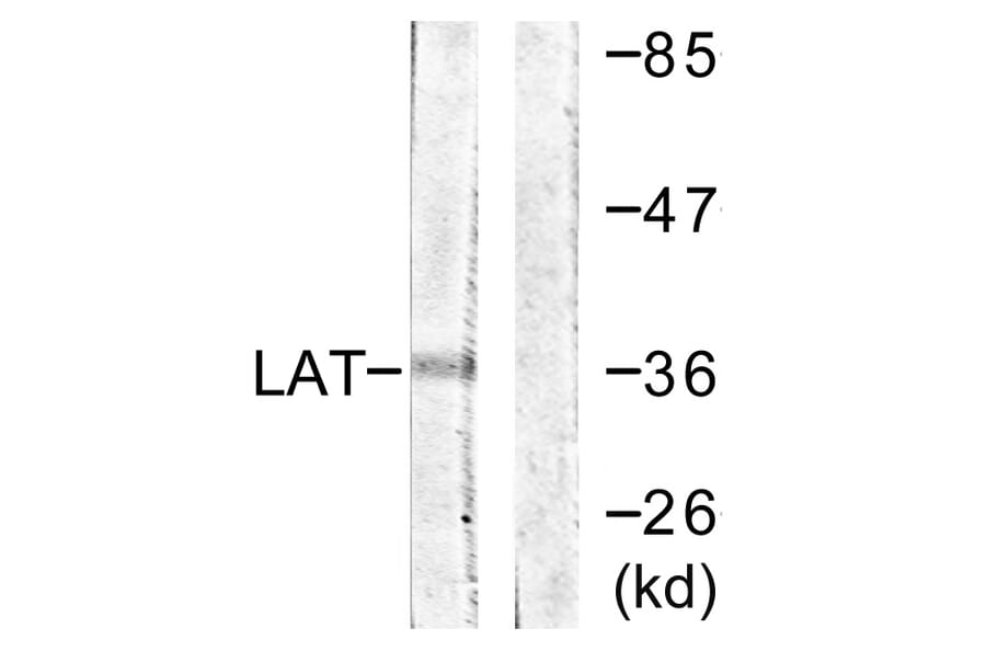 Western Blot - Anti-LAT Antibody (B0669) - Antibodies.com