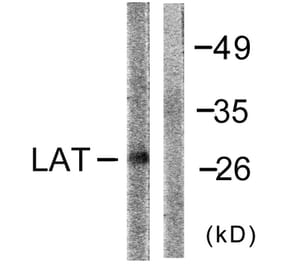 Western Blot - Anti-LAT Antibody (B0504) - Antibodies.com