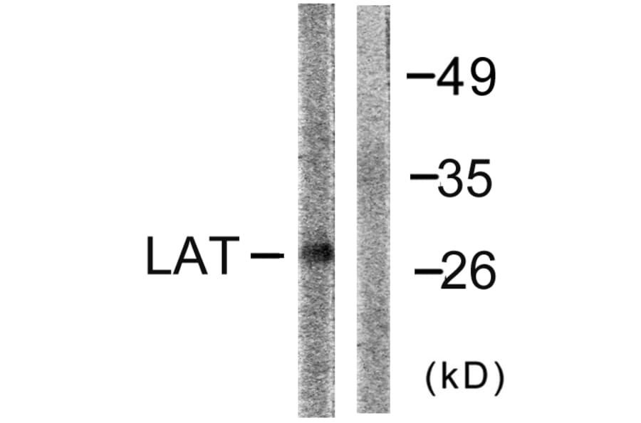 Western Blot - Anti-LAT Antibody (B0504) - Antibodies.com