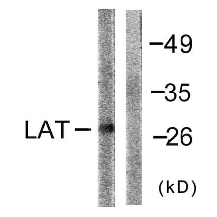 Western Blot - Anti-LAT Antibody (B0504) - Antibodies.com