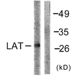 Western Blot - Anti-LAT Antibody (B0504) - Antibodies.com