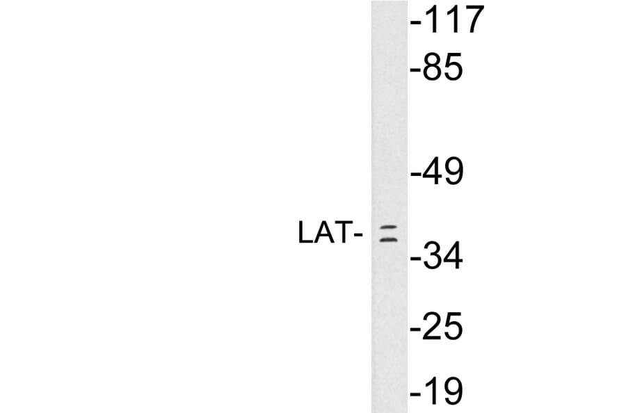 Western Blot - Anti-LAT Antibody (R12-2226) - Antibodies.com