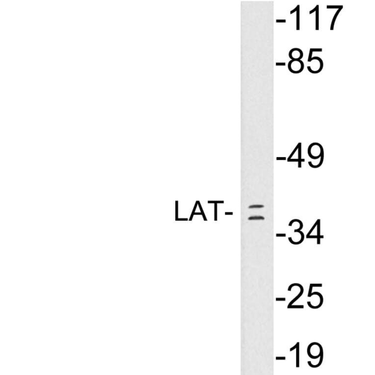 Western Blot - Anti-LAT Antibody (R12-2226) - Antibodies.com