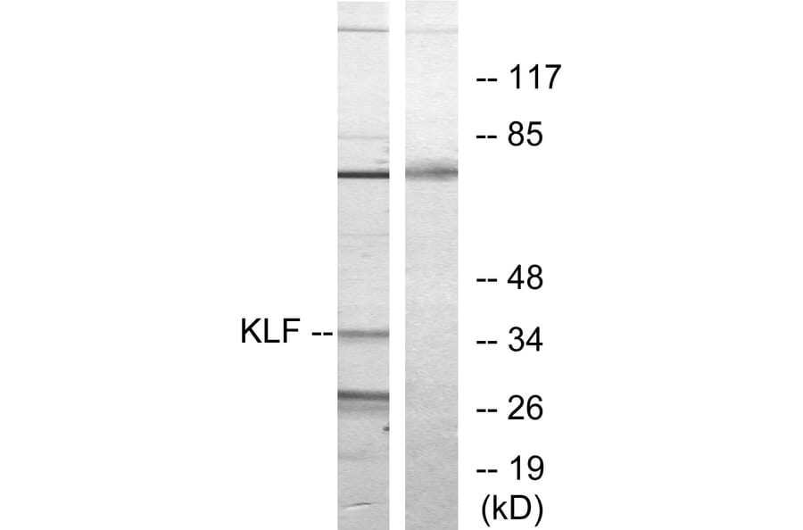 Western Blot - Anti-KLF Antibody (C10971) - Antibodies.com