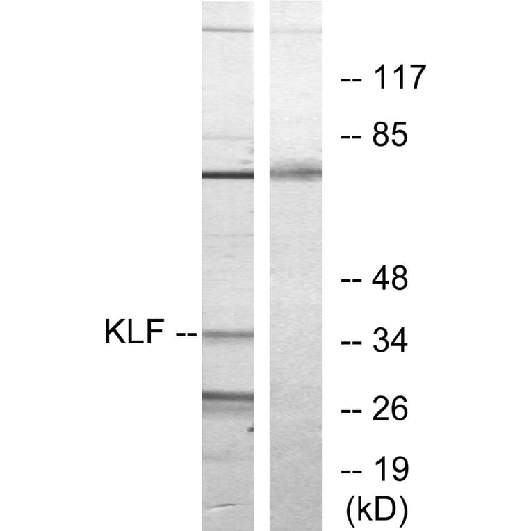 Western Blot - Anti-KLF Antibody (C10971) - Antibodies.com