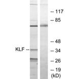 Western Blot - Anti-KLF Antibody (C10971) - Antibodies.com