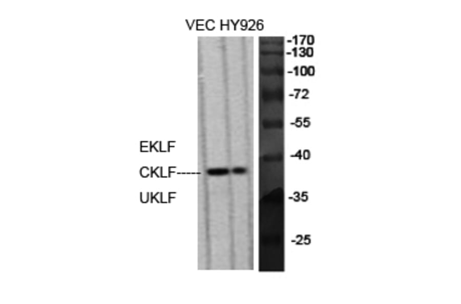 Western Blot - Anti-KLF Antibody (C10971) - Antibodies.com