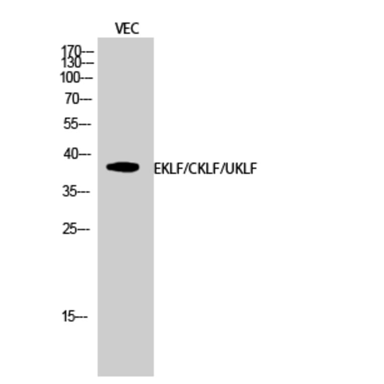 Western Blot - Anti-KLF Antibody (C10971) - Antibodies.com