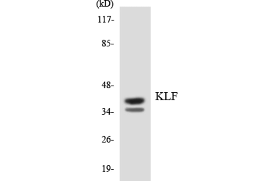 Western Blot - Anti-KLF Antibody (R12-2955) - Antibodies.com