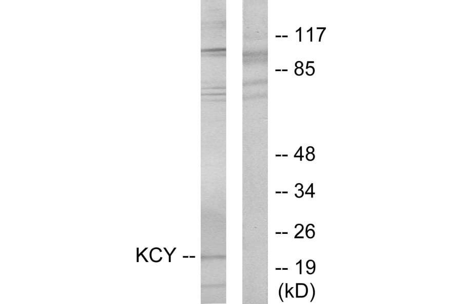 Western Blot - Anti-KCY Antibody (C10514) - Antibodies.com