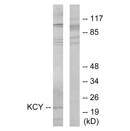 Western Blot - Anti-KCY Antibody (C10514) - Antibodies.com