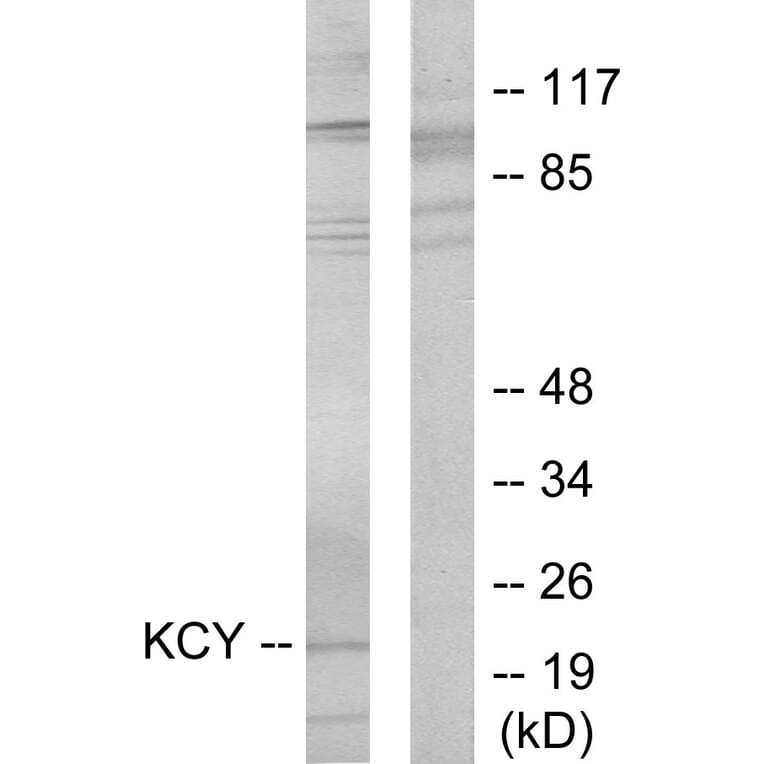 Western Blot - Anti-KCY Antibody (C10514) - Antibodies.com