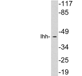 Western Blot - Anti-Ihh Antibody (R12-2198) - Antibodies.com