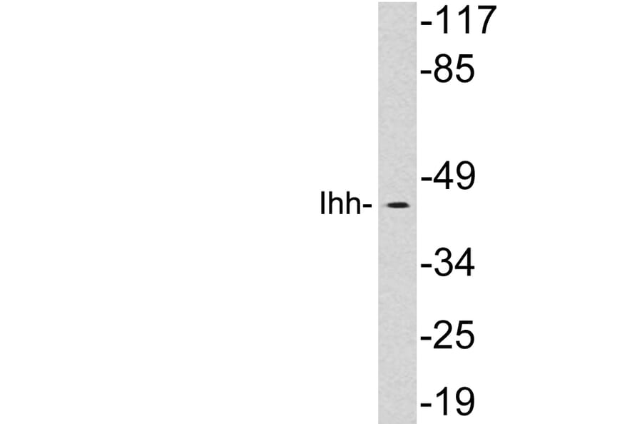 Western Blot - Anti-Ihh Antibody (R12-2198) - Antibodies.com