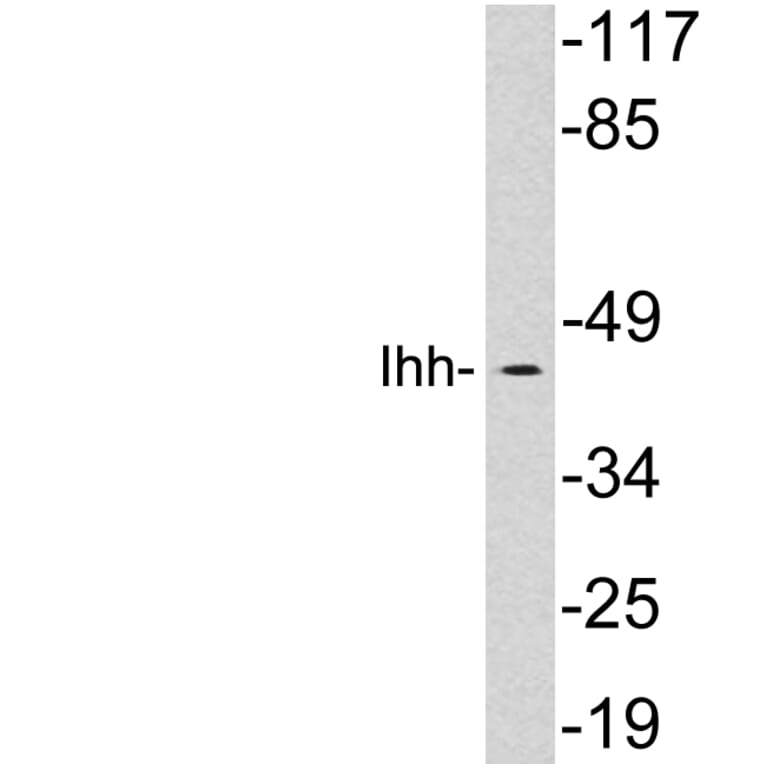 Western Blot - Anti-Ihh Antibody (R12-2198) - Antibodies.com