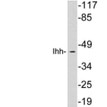 Western Blot - Anti-Ihh Antibody (R12-2198) - Antibodies.com