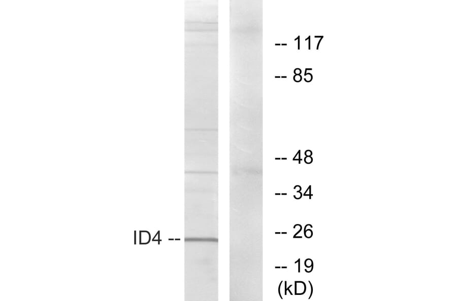 Western Blot - Anti-ID4 Antibody (C10631) - Antibodies.com