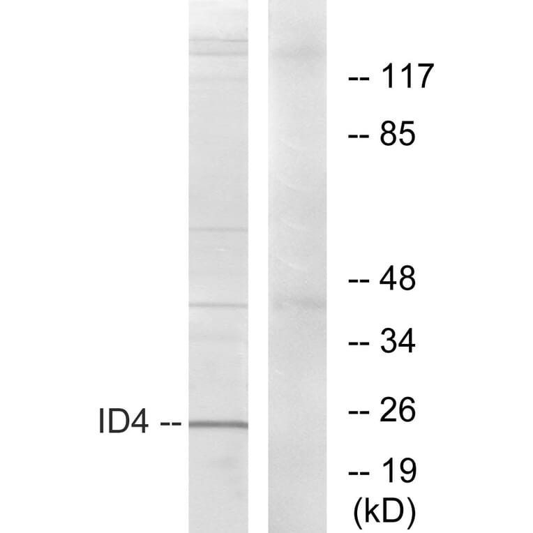 Western Blot - Anti-ID4 Antibody (C10631) - Antibodies.com