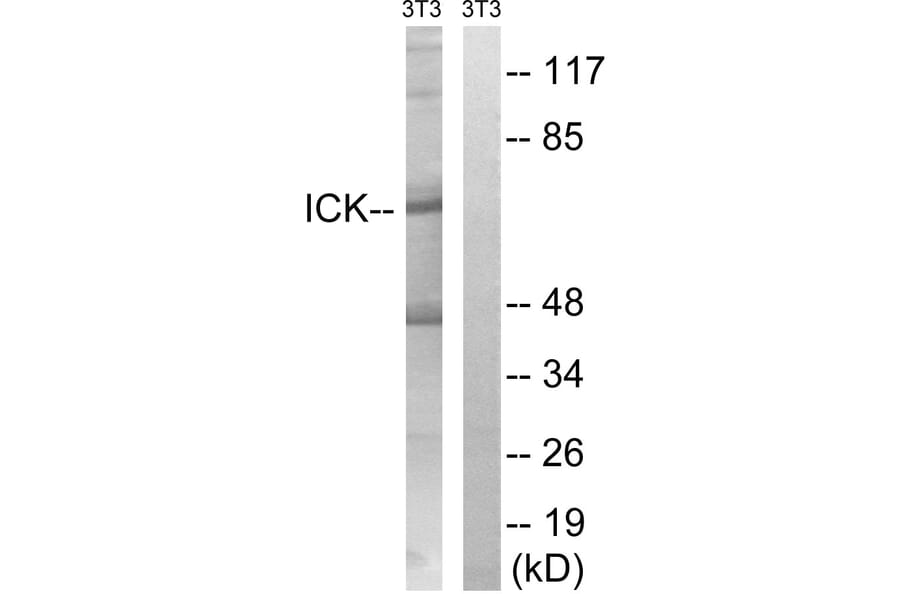Western Blot - Anti-ICK Antibody (B8112) - Antibodies.com