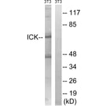Western Blot - Anti-ICK Antibody (B8112) - Antibodies.com