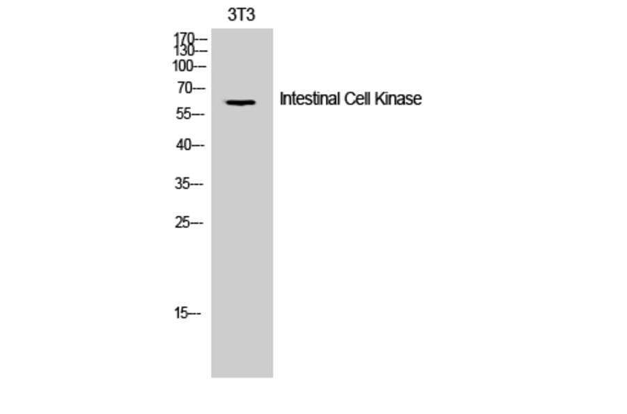 Western Blot - Anti-ICK Antibody (B8112) - Antibodies.com