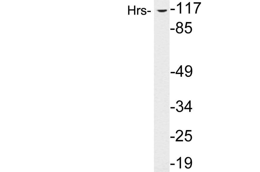 Western Blot - Anti-Hrs Antibody (R12-2187) - Antibodies.com