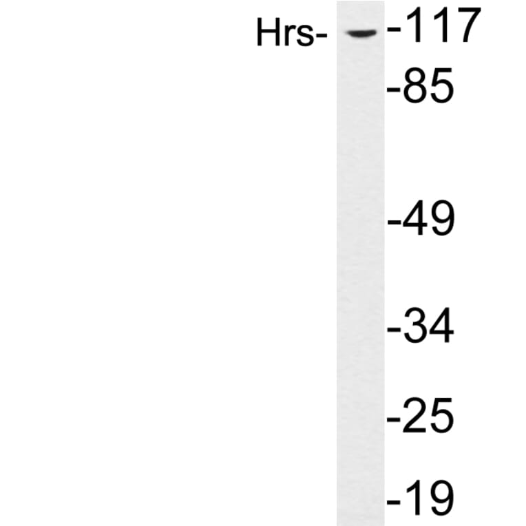 Western Blot - Anti-Hrs Antibody (R12-2187) - Antibodies.com