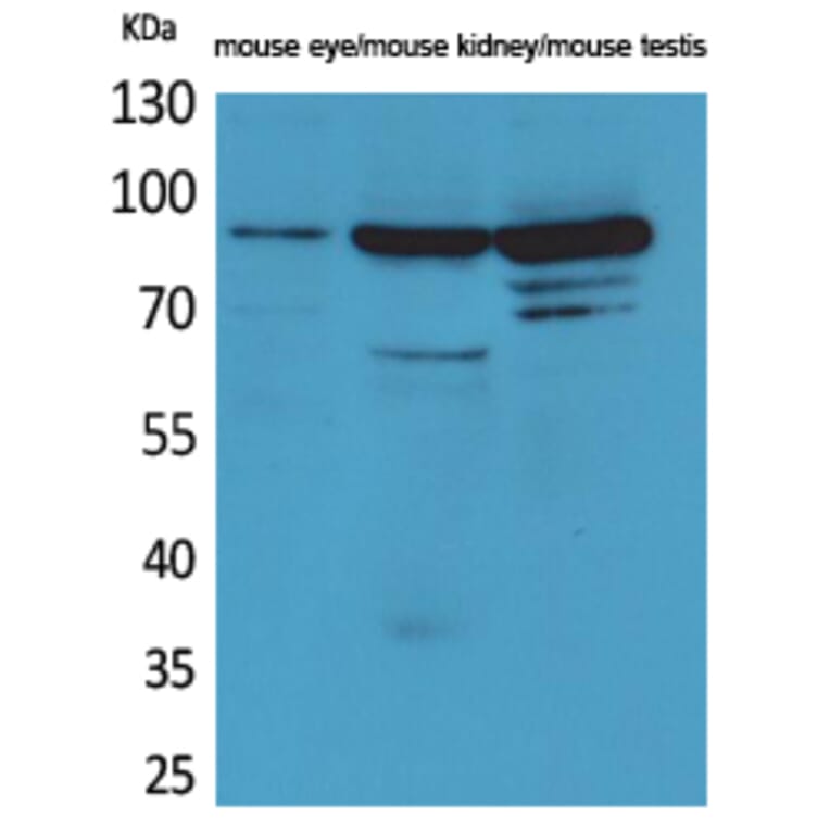 Western Blot - Anti-HGS Antibody (C30027) - Antibodies.com