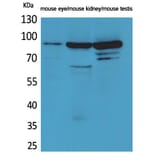 Western Blot - Anti-HGS Antibody (C30027) - Antibodies.com