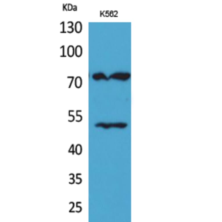Western Blot - Anti-HDC Antibody (C30265) - Antibodies.com