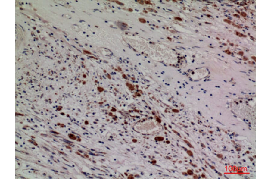 Immunohistochemistry - Anti-HDC Antibody (C30265) - Antibodies.com