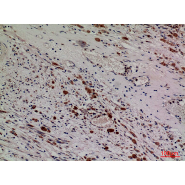 Immunohistochemistry - Anti-HDC Antibody (C30265) - Antibodies.com