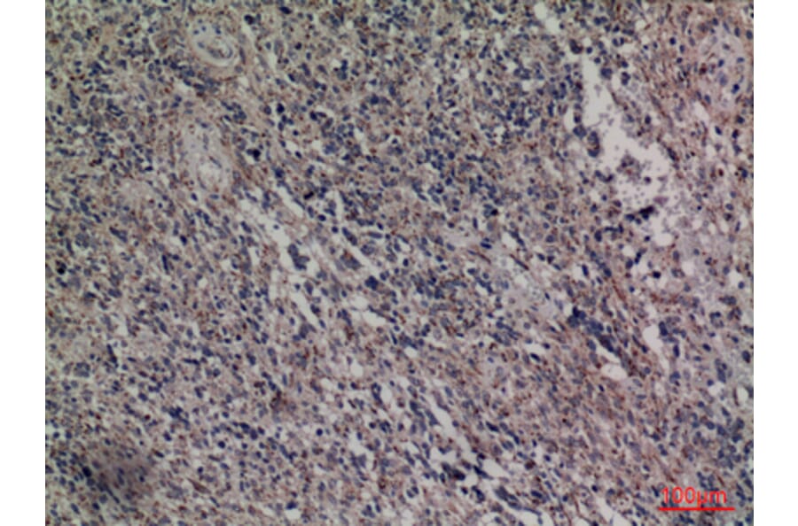 Immunohistochemistry - Anti-HDC Antibody (C30265) - Antibodies.com