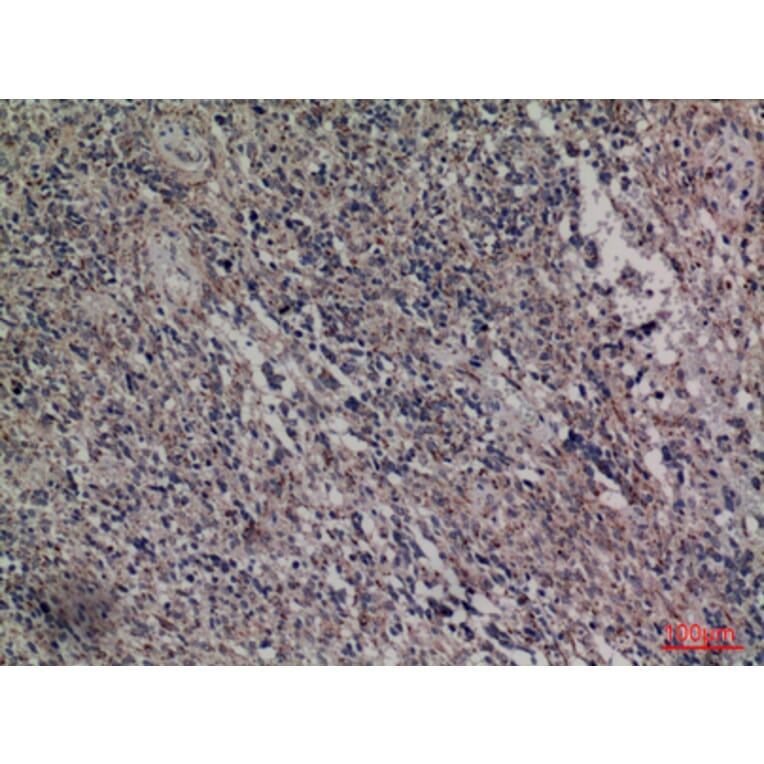 Immunohistochemistry - Anti-HDC Antibody (C30265) - Antibodies.com
