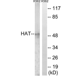 Western Blot - Anti-HAT Antibody (C0356) - Antibodies.com