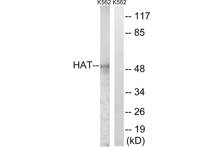 Western Blot - Anti-HAT Antibody (C0356) - Antibodies.com