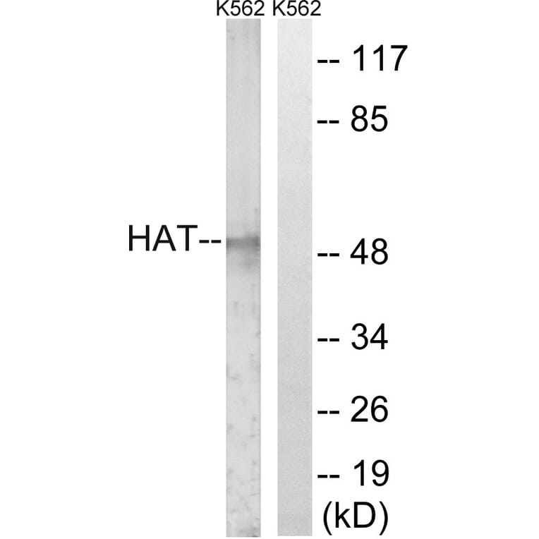 Western Blot - Anti-HAT Antibody (C0356) - Antibodies.com