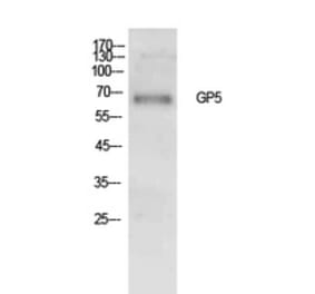 Western Blot - Anti-GP5 Antibody (C30354) - Antibodies.com